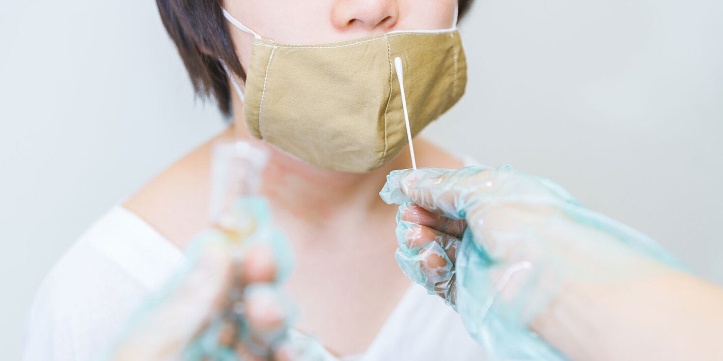  PCR diagnostic tests for COVID-19