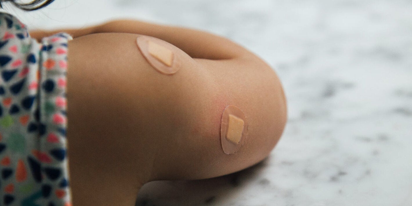 Recently vaccinated child 