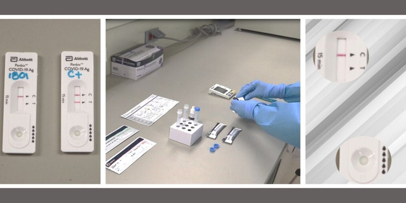 Pruebas de detección de antígenos de SARS-CoV-2