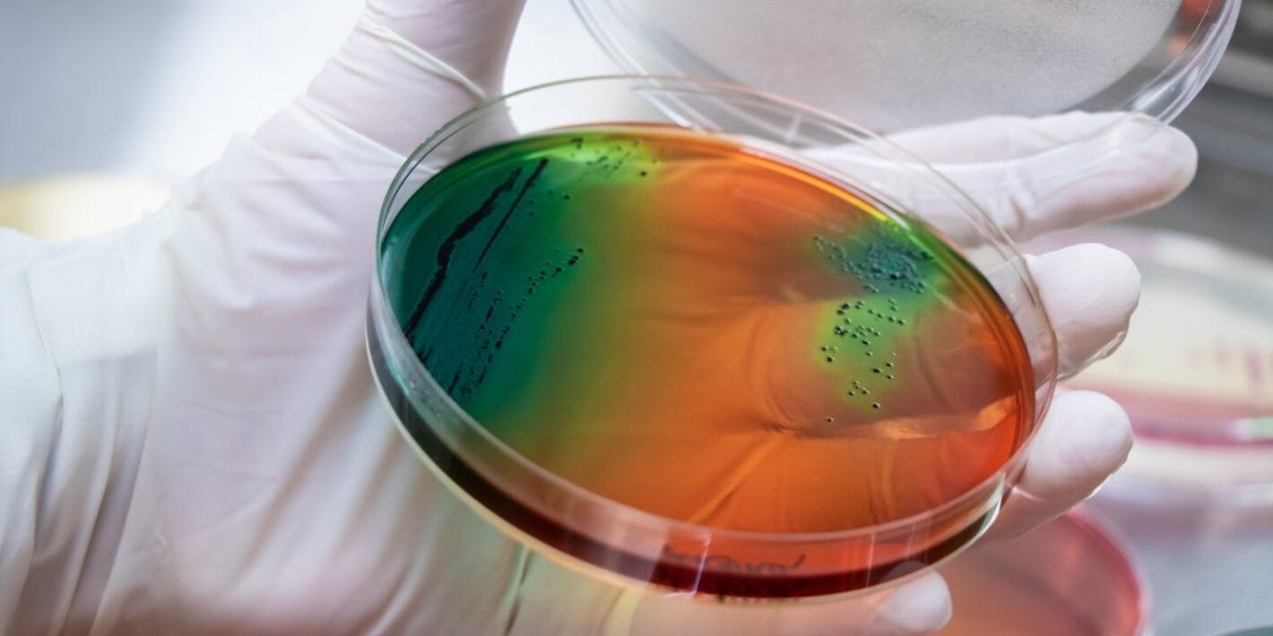 Invitamos  a postular a profesional bioquímico o microbiólogo con experiencia en microbiología  a consultoría 