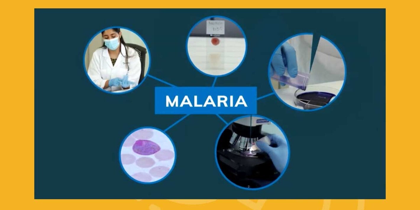 Lanzamiento de curso teórico de autoaprendizaje Diagnóstico Microscópico de la Malaria