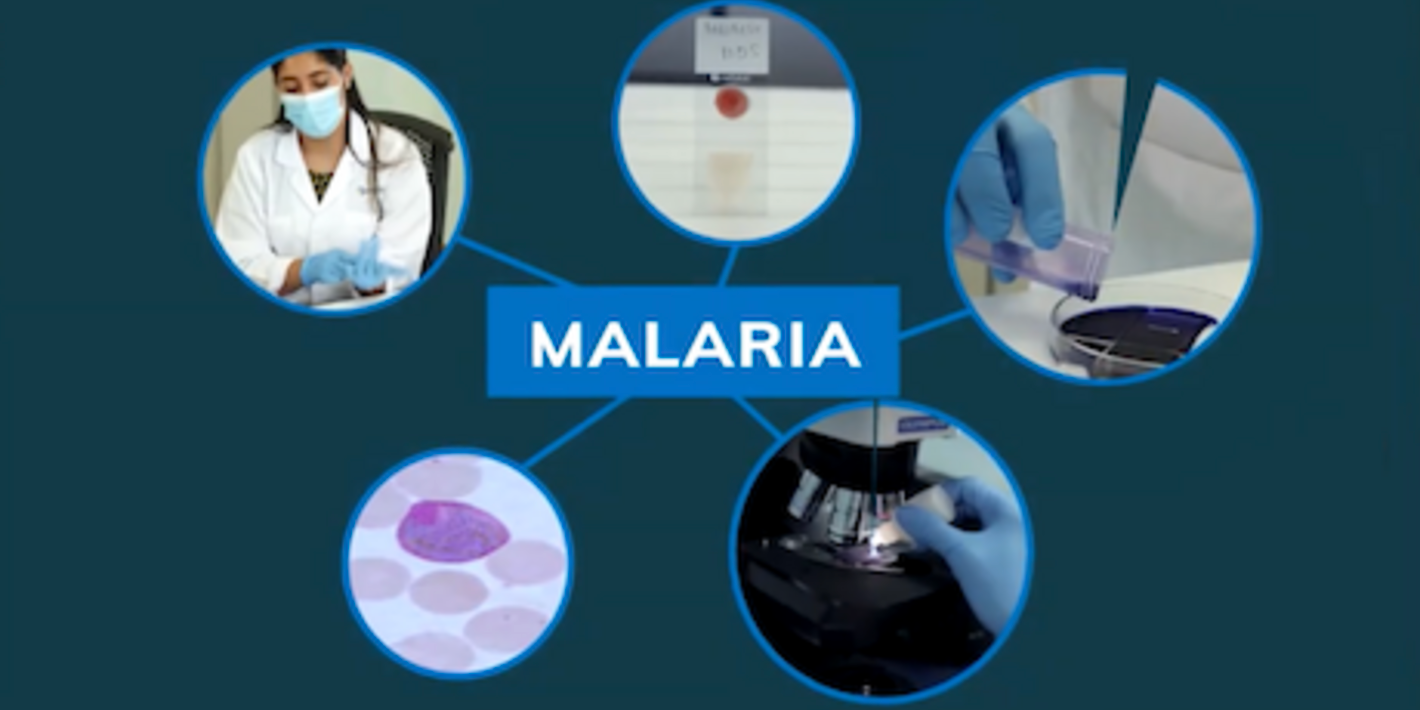 CursoVirtual_Malaria