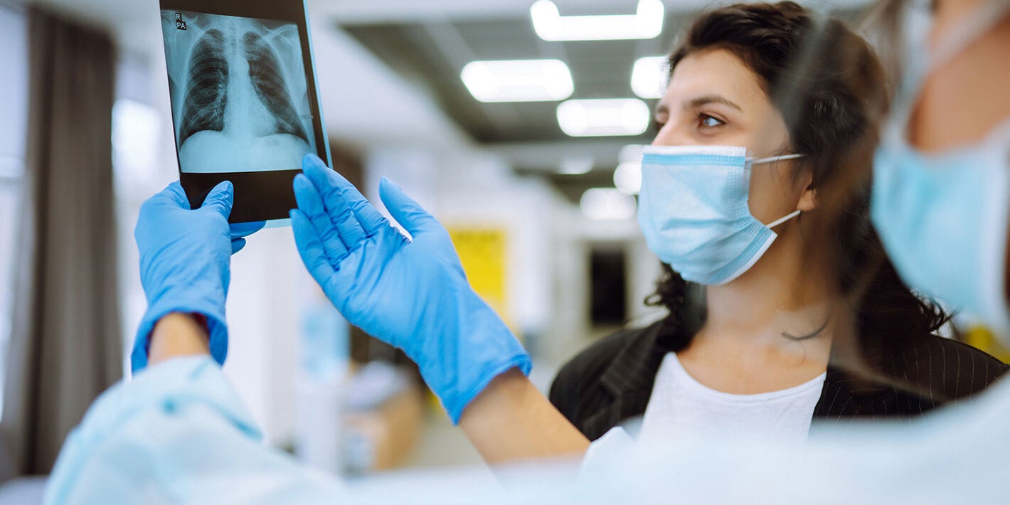 Radiografía de pulmones
