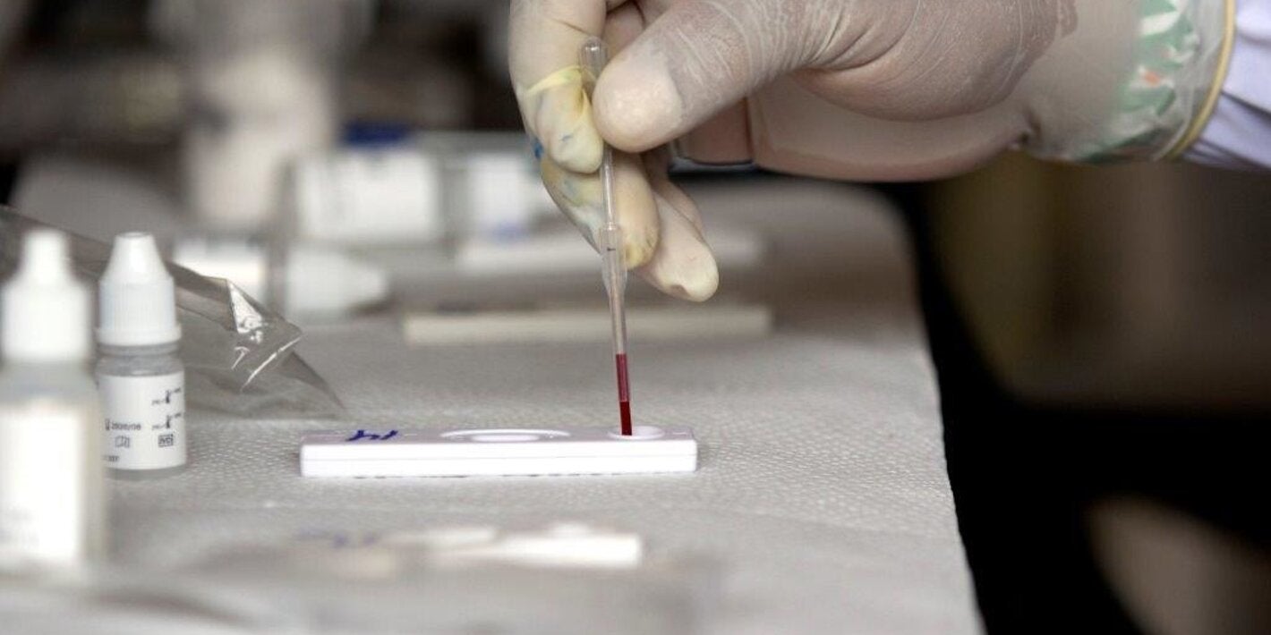 pruebas para hepatitis