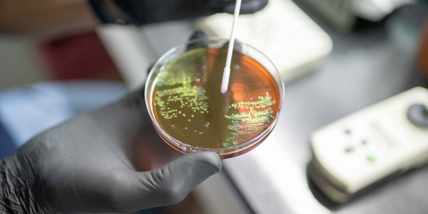 Cultivo bacteriano al que se le realizarán pruebas de identificación y sensibilidad antimicrobiana.