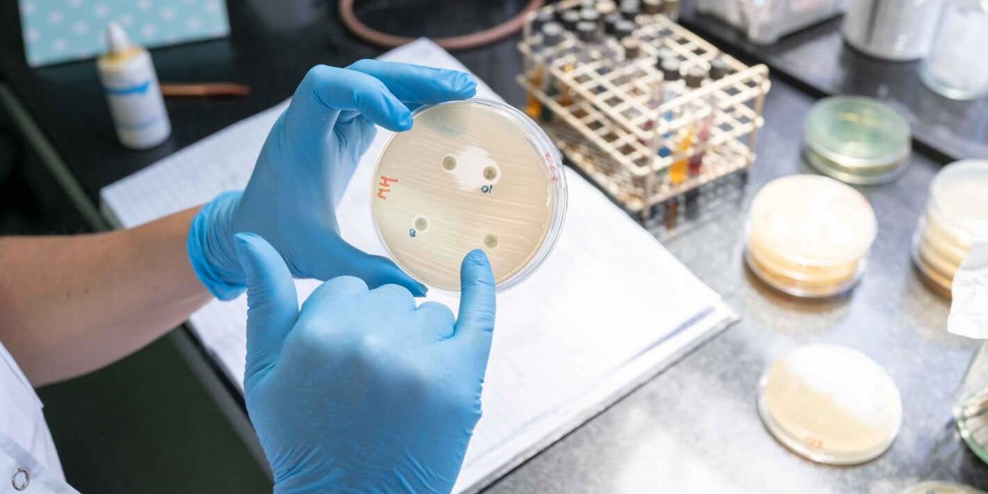 La imagen muestra la detección de mecanismos de resistencia utilizando un método manual.