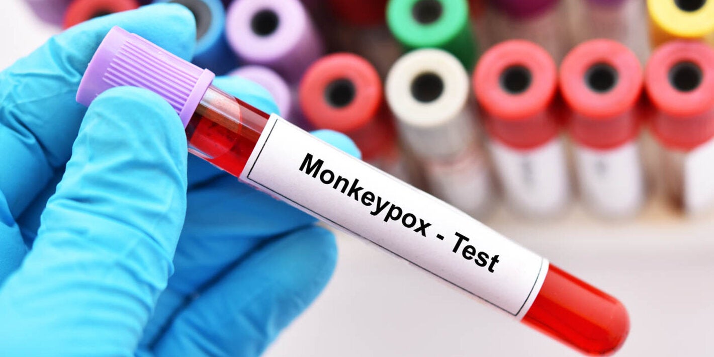 Testing for monkeypox at lab