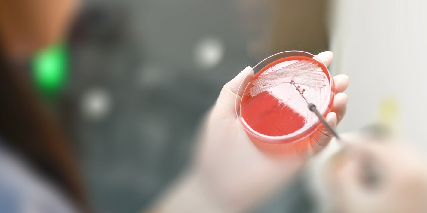 Lab testing of drug resisance pahogens