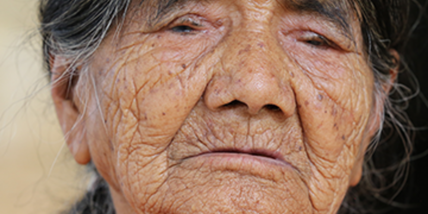 How Mexico eliminated trachoma, the leading preventable cause of blindness