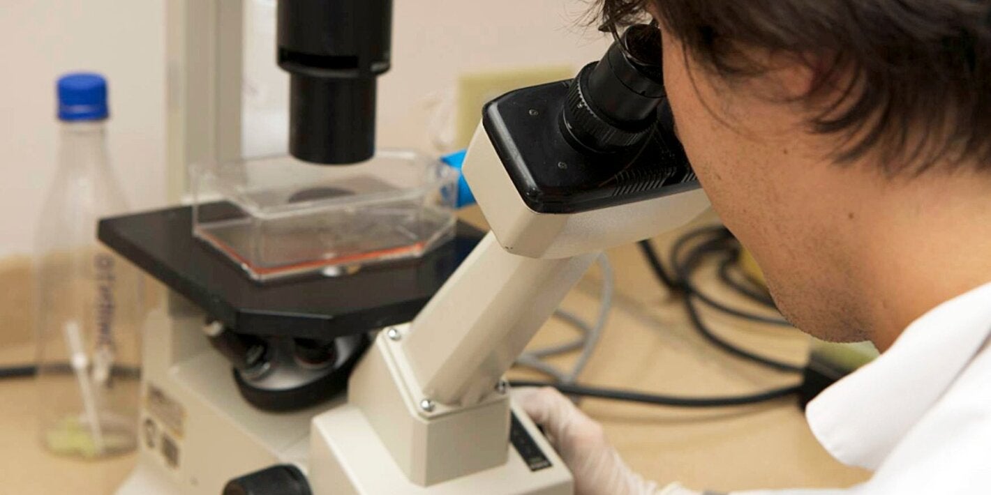 Exame HPV (Human Papilloma Virus) e Câncer Cervical