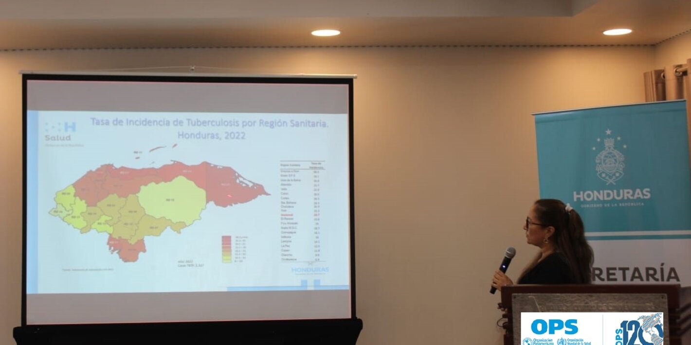 Presentación casos TB en Honduras