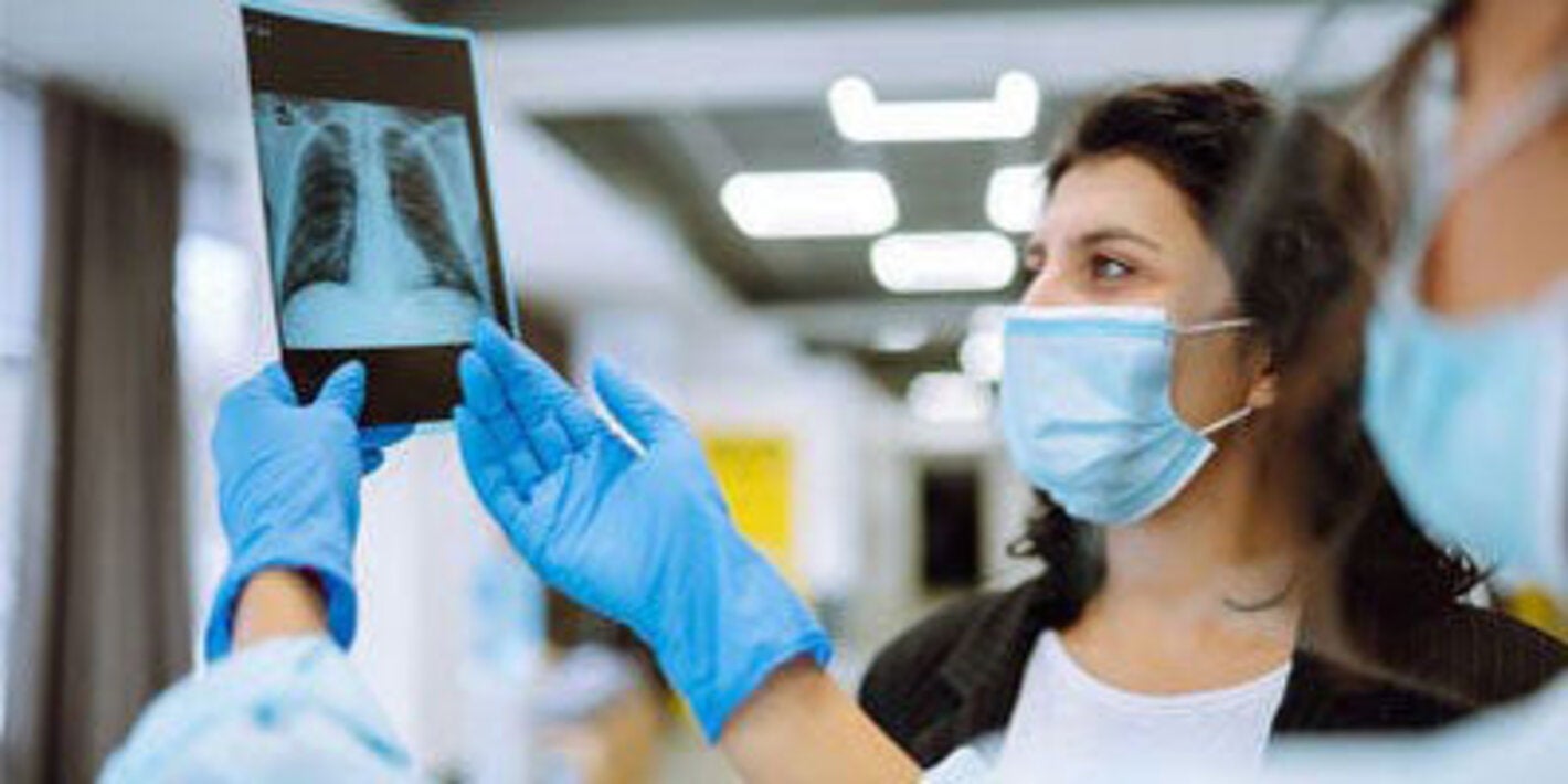 woman looking at an x-ray of lungs