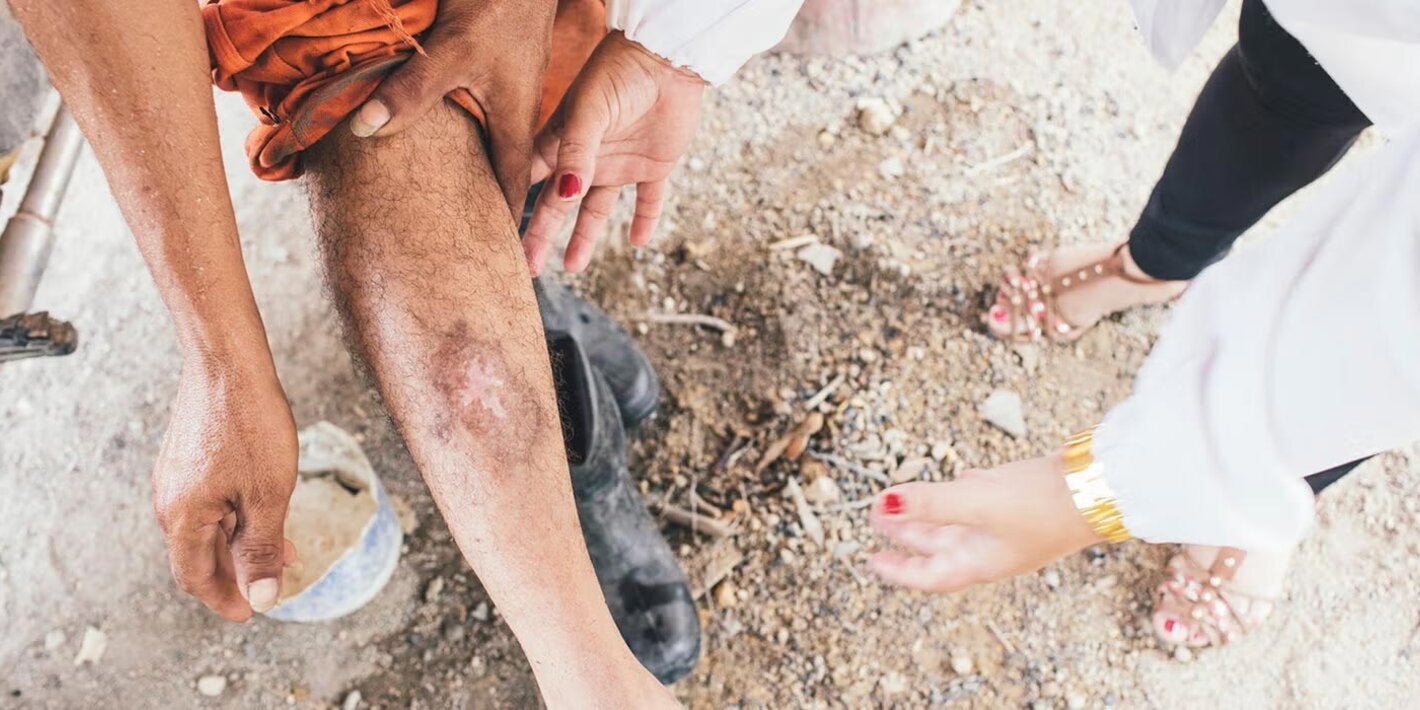 Historia de éxito: Primeras victorias contra la Leishmaniasis