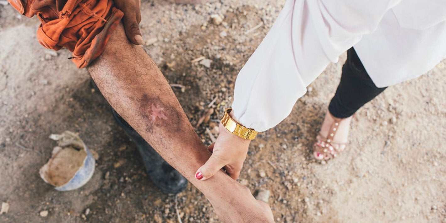 Persona con lesión característica de la leishmaniasis cutánea