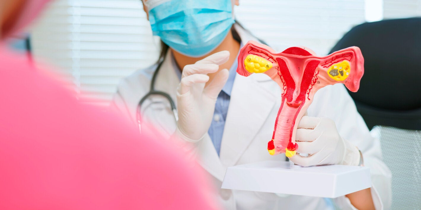 bra-cancer-colo-utero