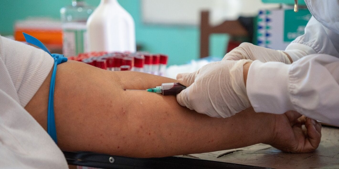 prueba hanta virus Bolivia