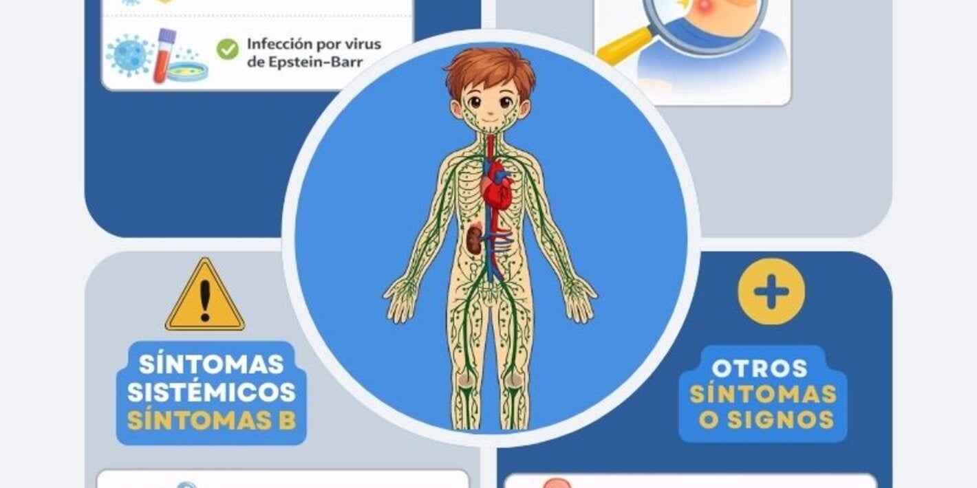 Infografía sobre el linfoma de Hodgkin