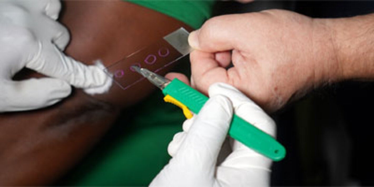 Journée mondiale contre la lèpre (maladie de Hansen) 2026