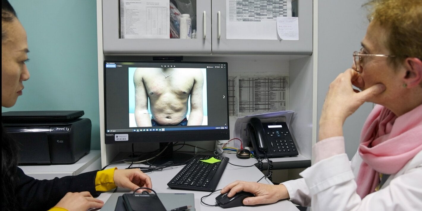 Chile elimina la lepra