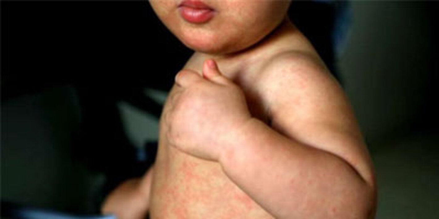 Update on the review of measles elimination status