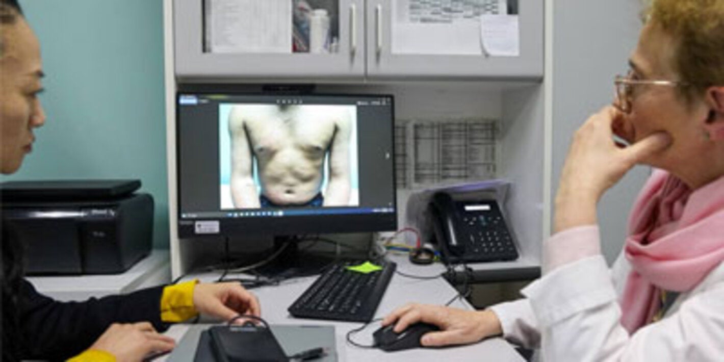 Chile’s long path to eliminating leprosy