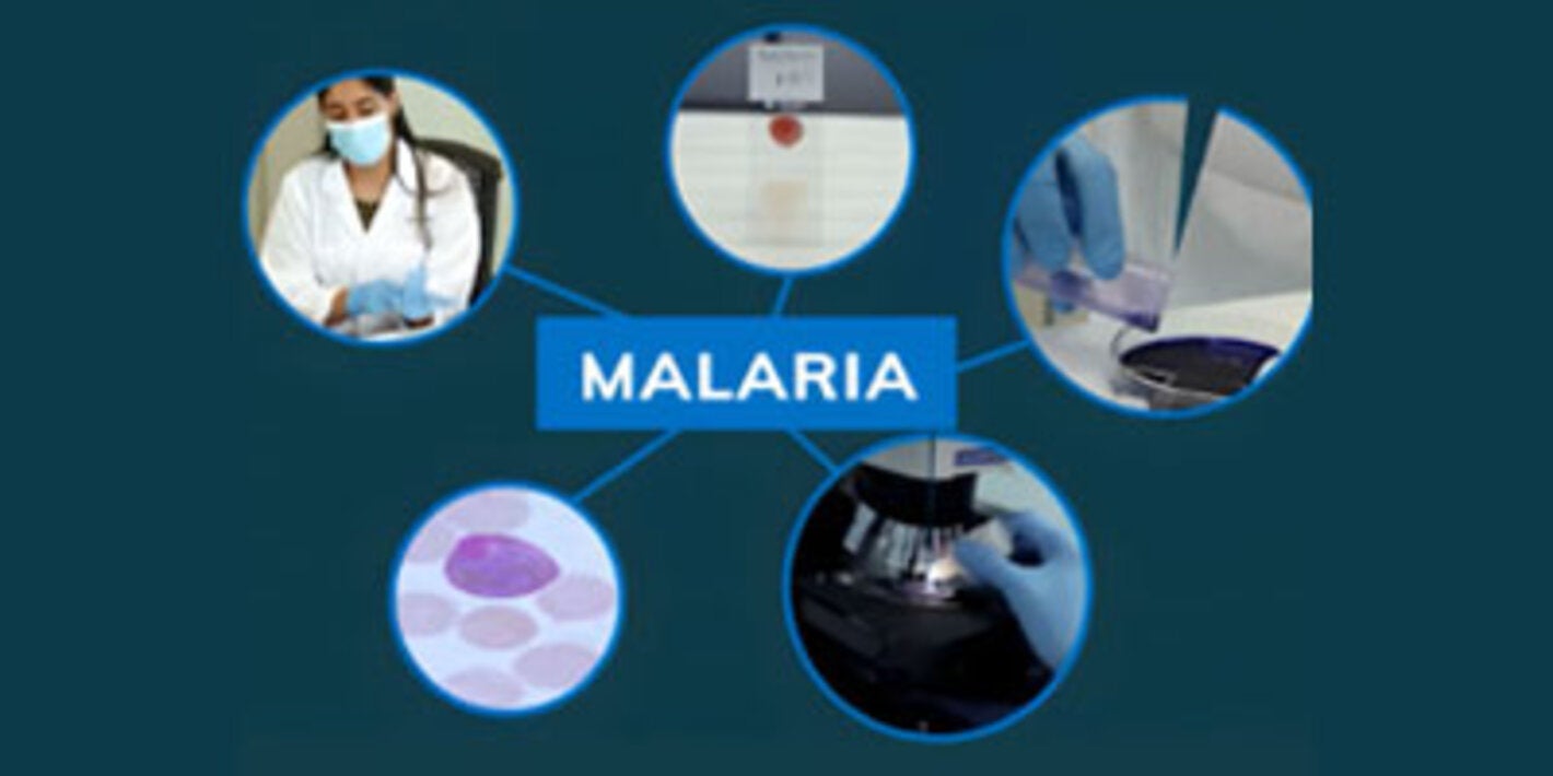 Curso virtual: Diagnóstico microscópico de la malaria