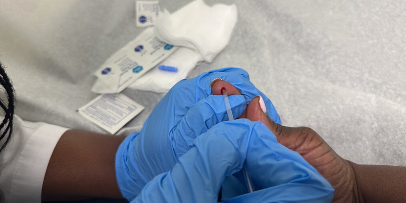 Test VIH Mother to Child