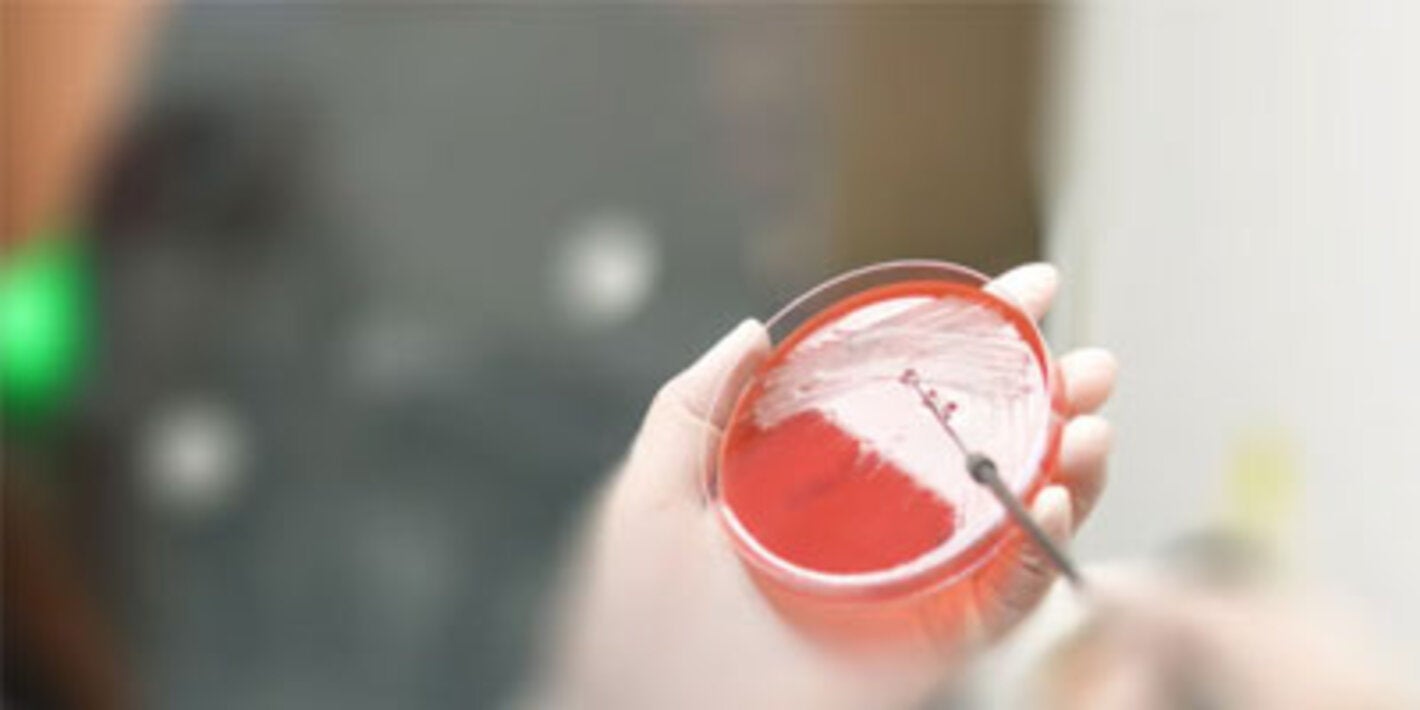 Antimicrobial resistance: Americas adopt new regional action plan