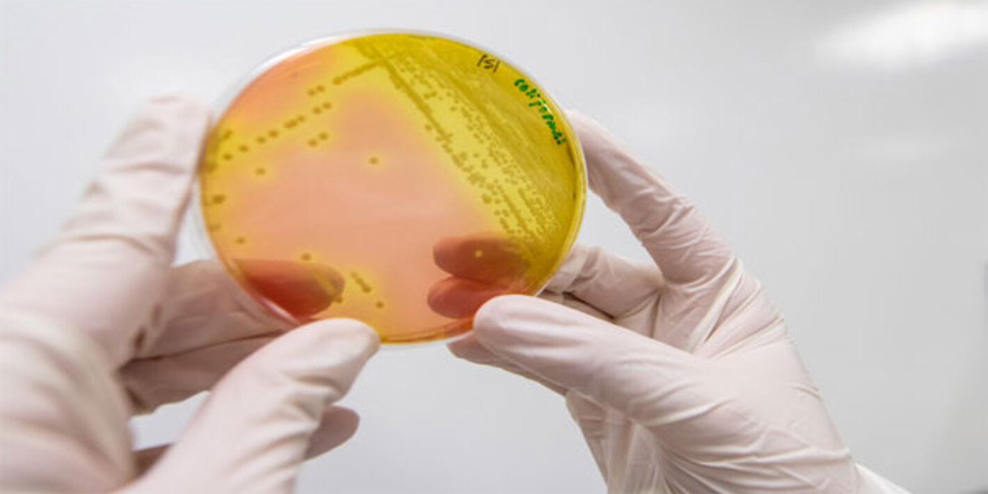 foto de bacteria en un  recipiente