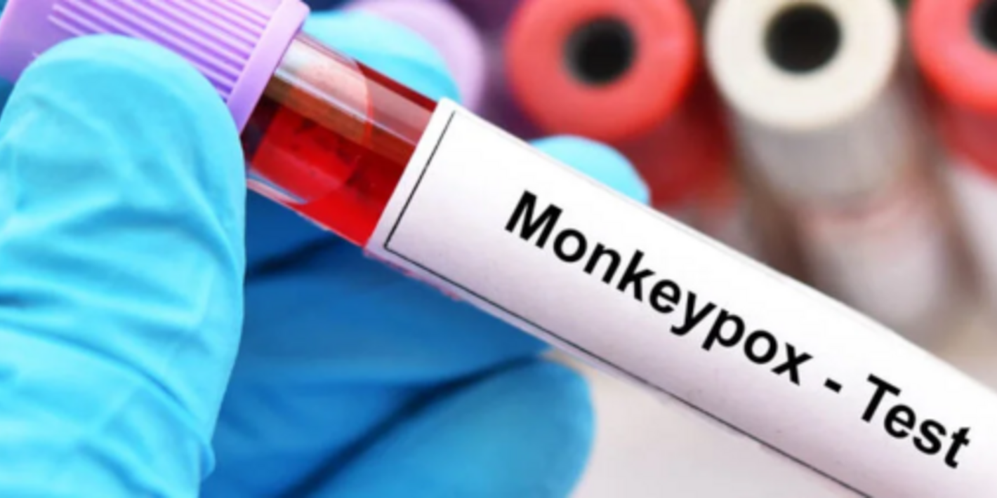 En Ecuador, más de 500 personas participaron en el seminario virtual sobre viruela símica