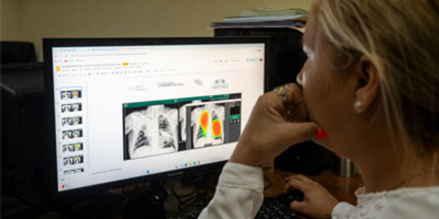 The End TB Strategy: Progress in the Americas in 2024