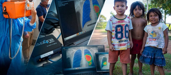 Día mundial de la tuberculosis 2026