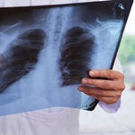 Doctor holding X-ray