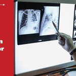 Micosis en personas con infección avanzada por el VIH  en la Región de las Américas 