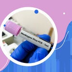 Webinar Viruela Símica y Reuniones Masivas