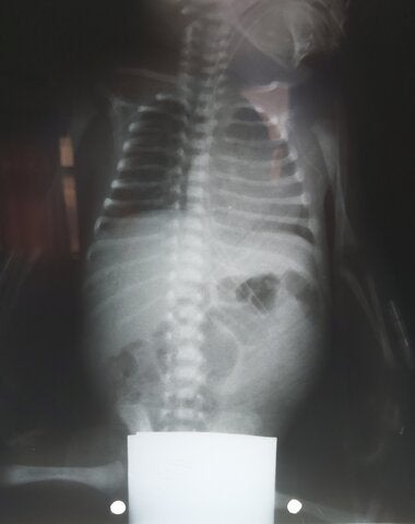 Hospital Nacional Alejandro Posadas