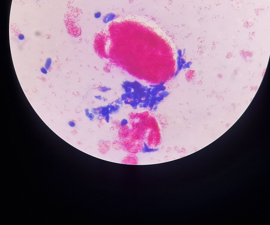 pathogen view from microscope