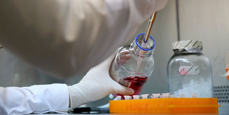 Epidemiological Alerts and Updates - laboratory picture 