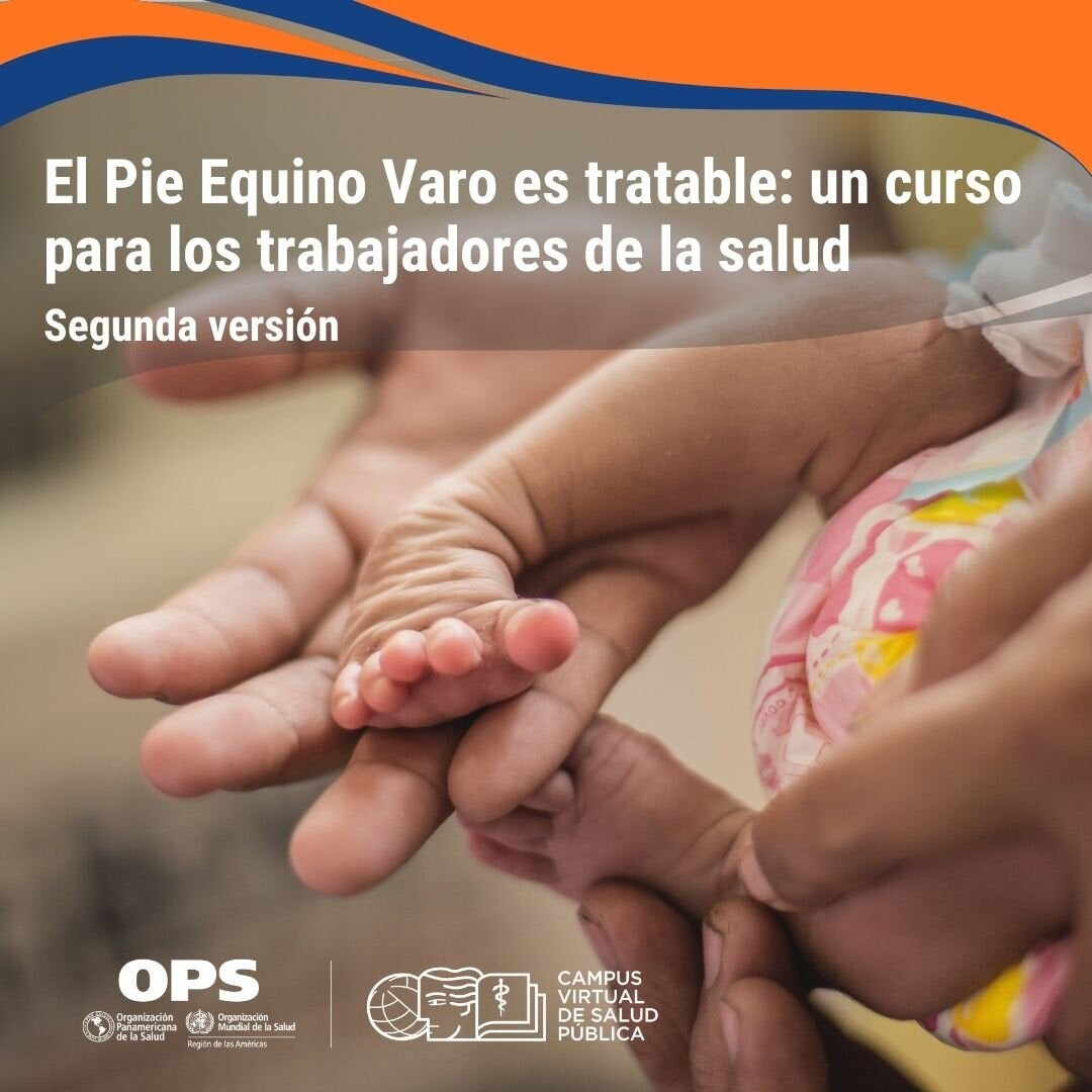 Foto de un pie equino varo de un bebé recién nacido en las manos de un adulto