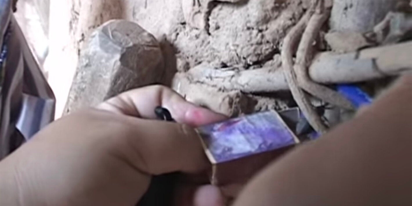 Chagas disease is a parasitic, systemic, and chronic disease caused by the protozoan Trypanosoma cruzi