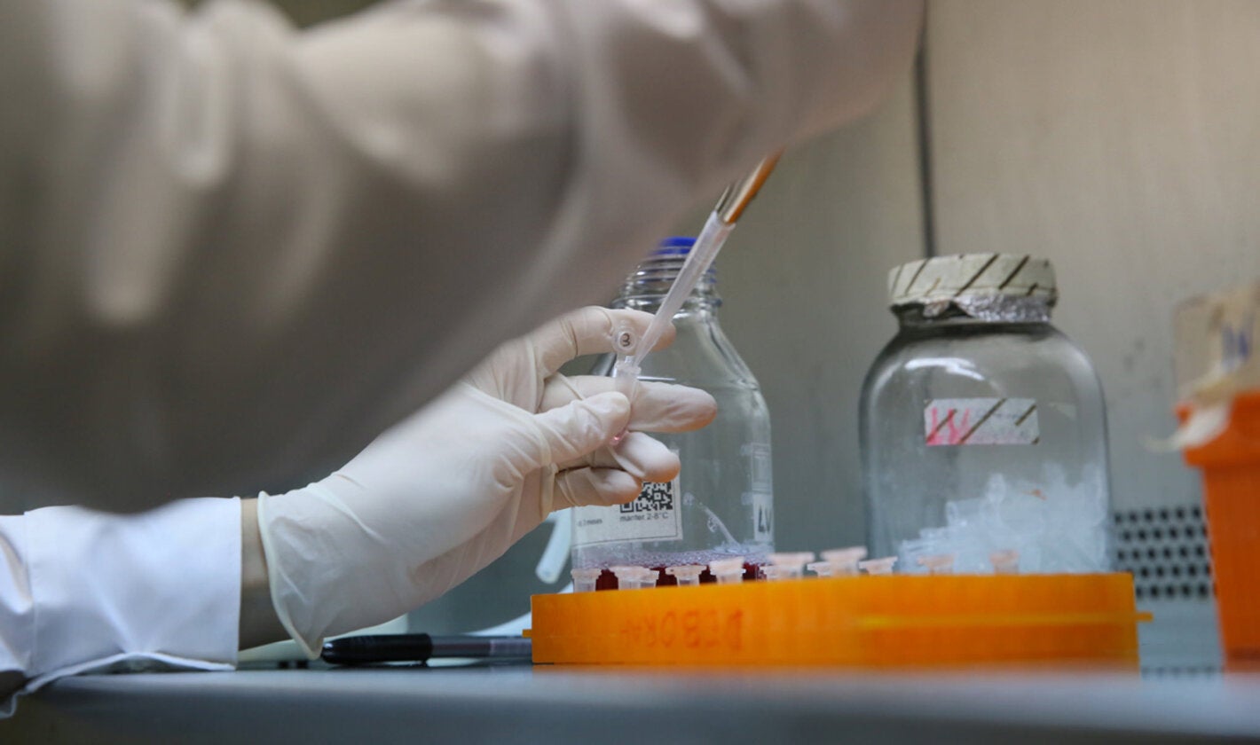 La iniciativa ShORRT sobre la investigación de la tuberculosis en la Región de las Américas