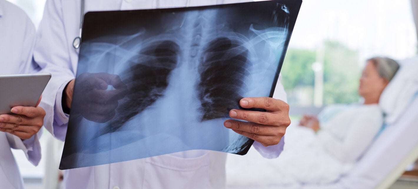 Doctor holding X-ray