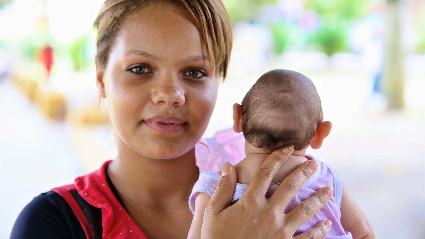 mother holding baby with microcephaly