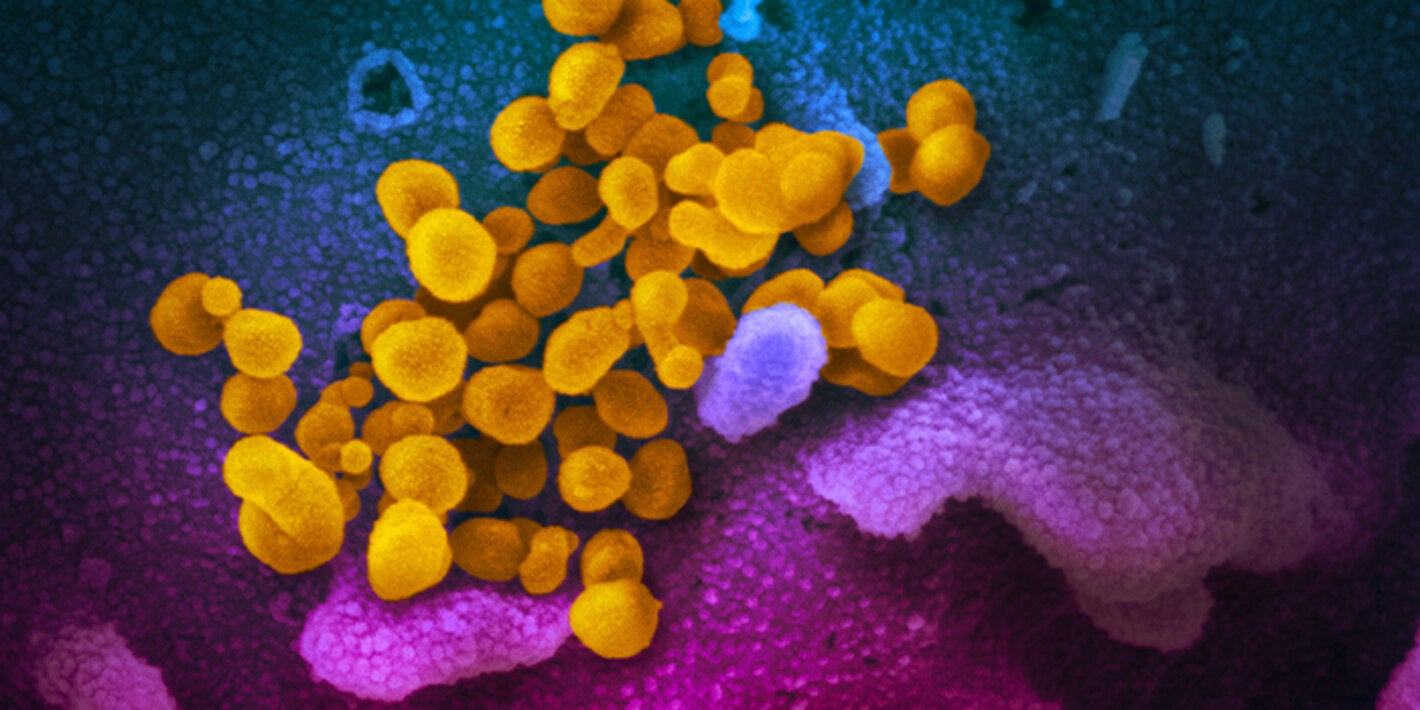  Imagen microscópica de COVID-19