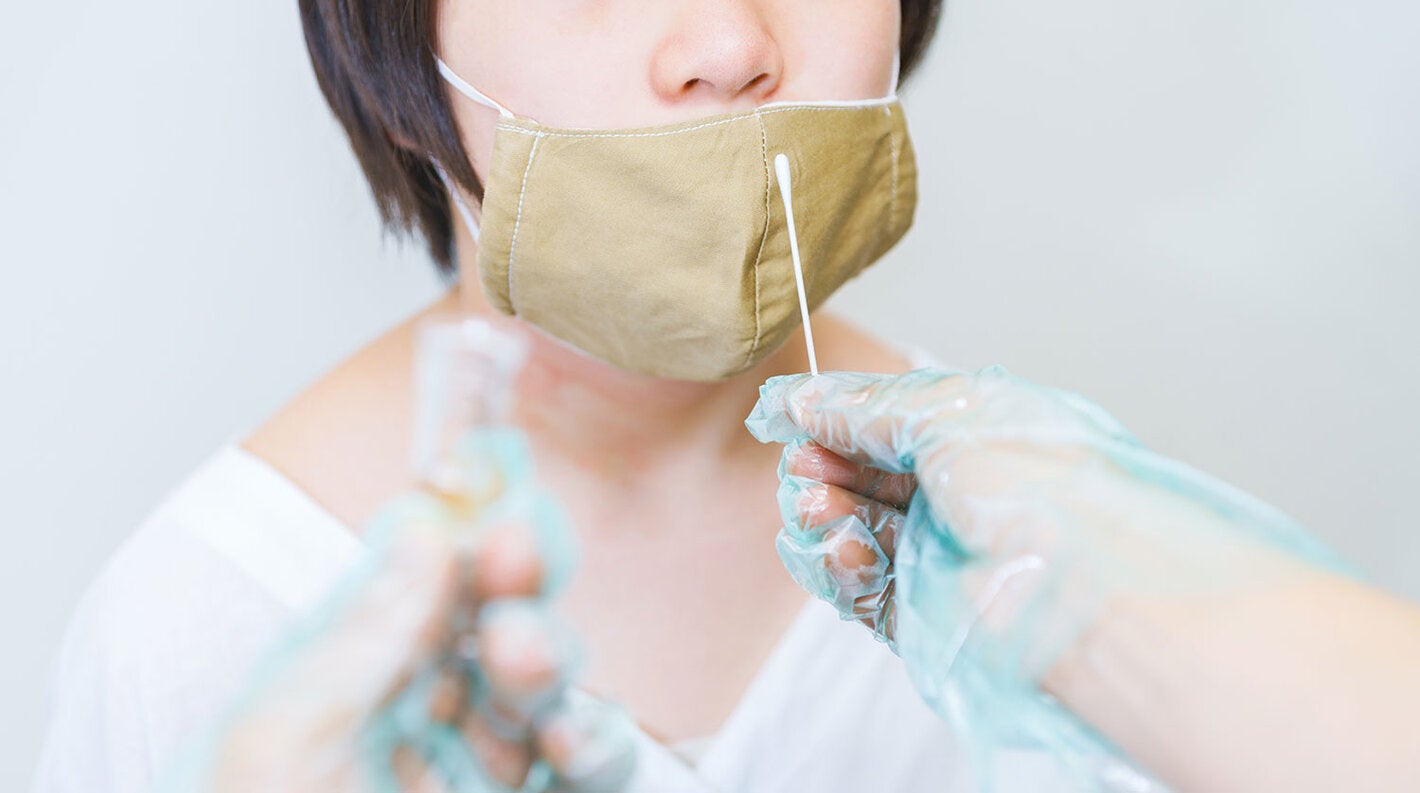  PCR diagnostic tests for COVID-19