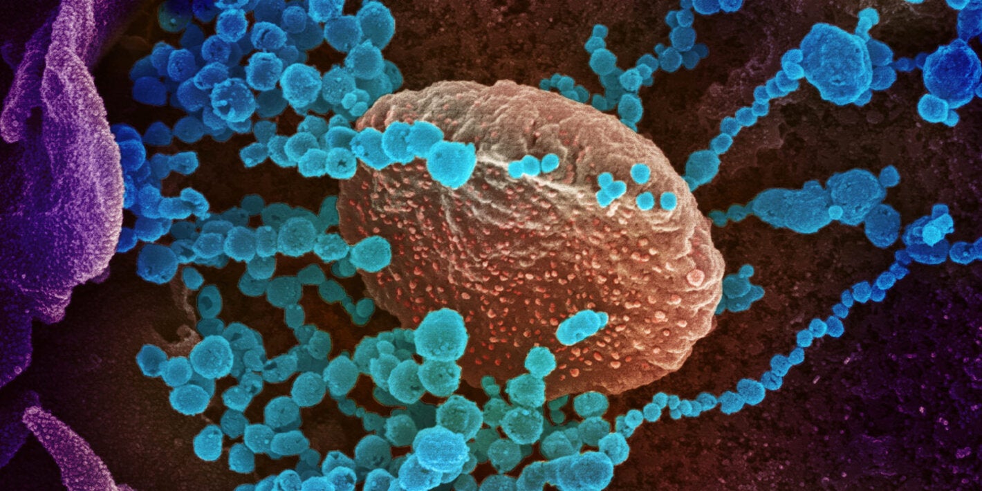 Electron microscope image of COVID-19