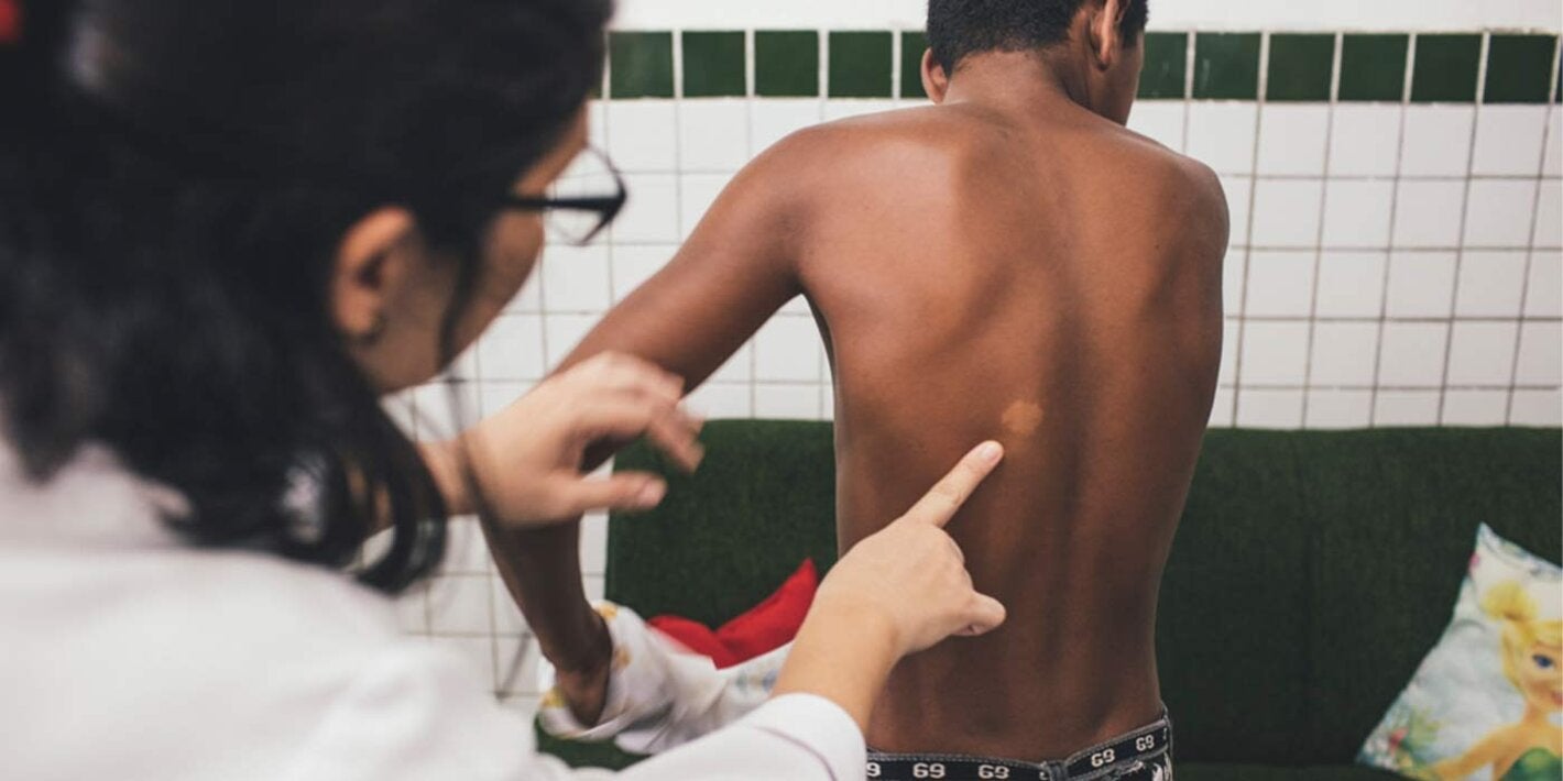  Médico examina paciente com hanseníase