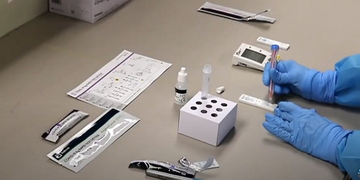 Prueba antígenos COVID-19