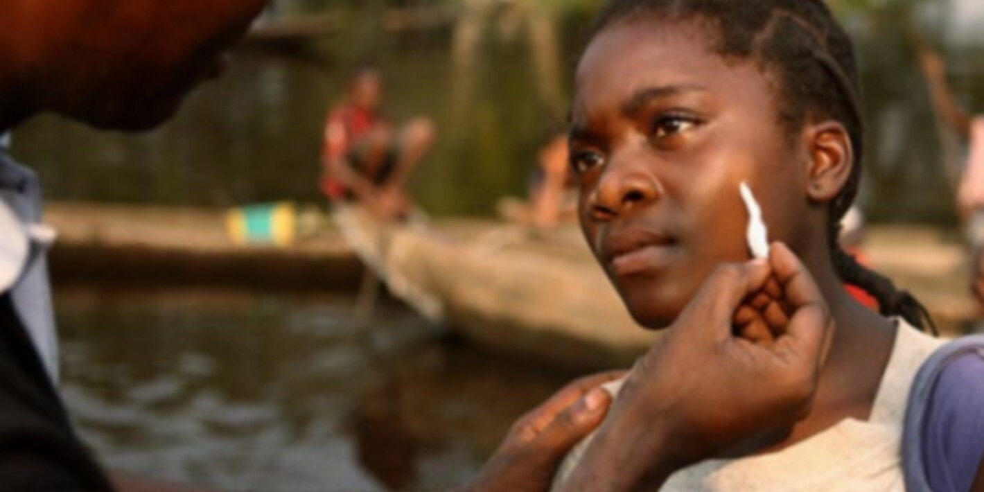 Young woman received treatment