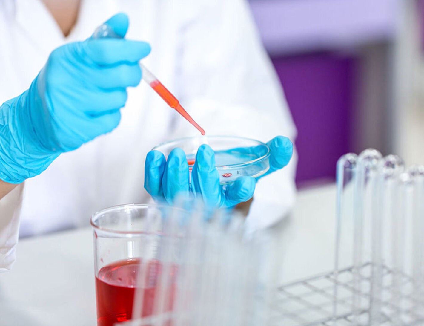 Mano de Bacteriologa inyectando sustancia roja a un recipiente